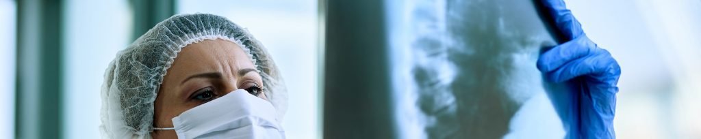 La inmunoterapia como nuevo abordaje del Cáncer de Pulmón